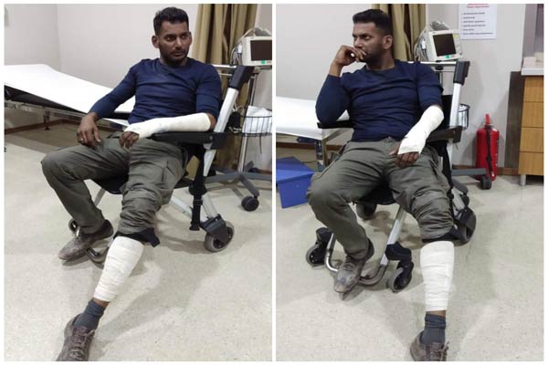 Vishal suffers serious injuries