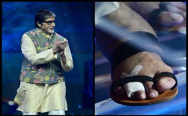 Did Amitabh Bachchan Fracture His Toe?