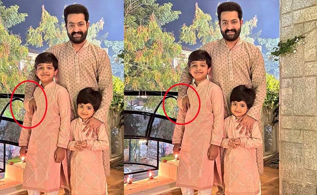 Shocker: NTR Undergoes Surgery